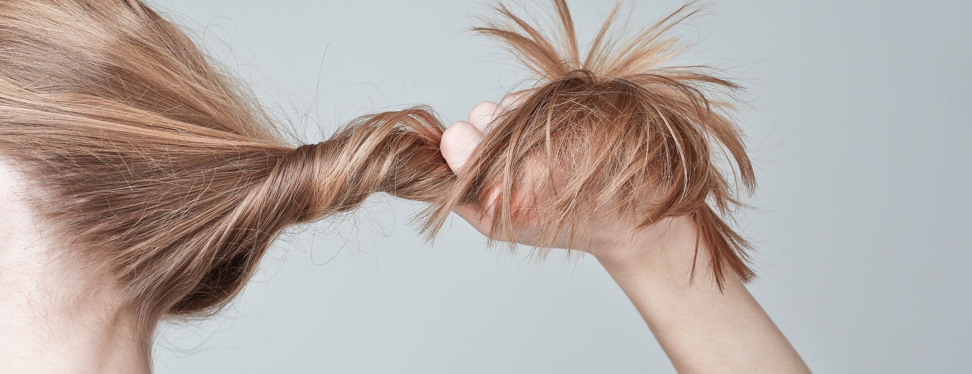 Tricotilomania: uma necessidade irreprimível de arrancar cabelos Tricotilomania: uma necessidade irreprimível de arrancar cabelos